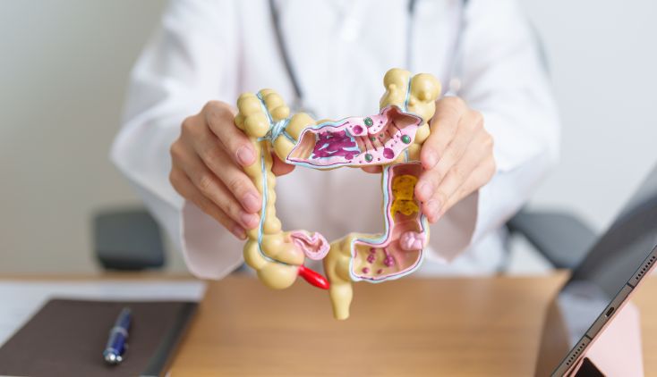 A doctor holding a plastic model of the large intestine.